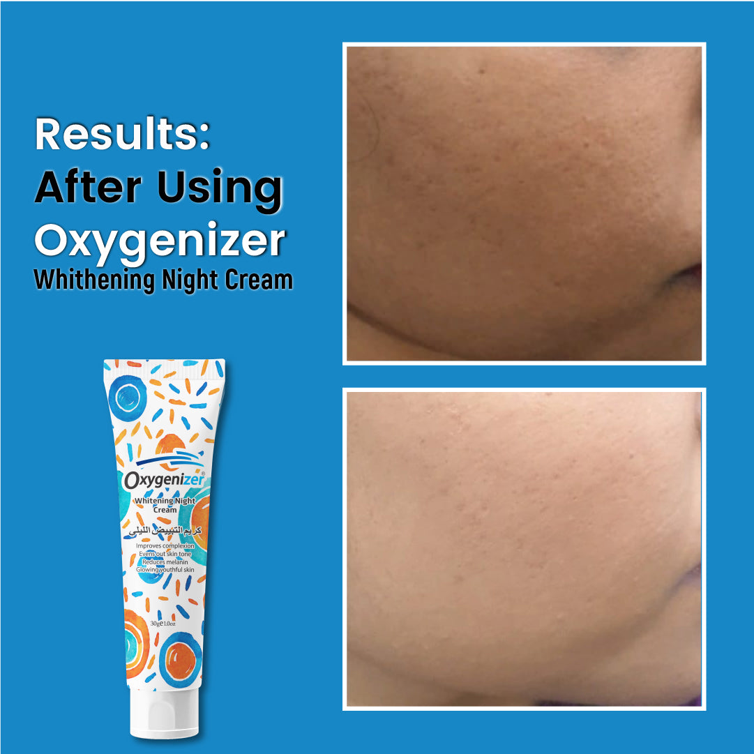 Oxygenizer - Best Skin Whitening Night Cream
